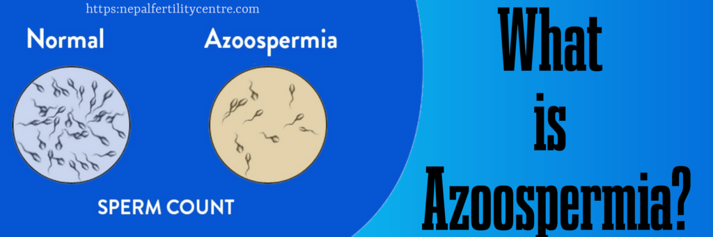 Azoospermia treatment cost in Nepal