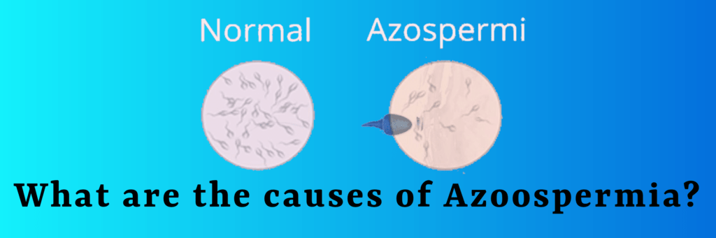 Azoospermia treatment cost in Nepal