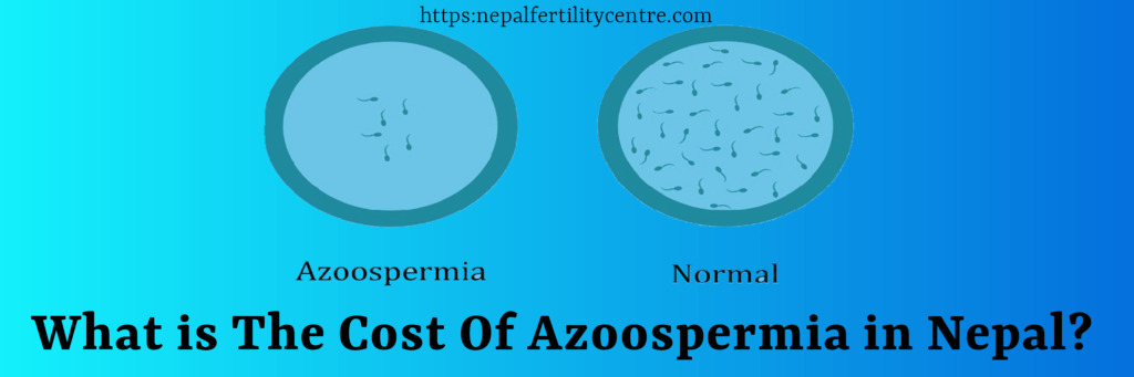 Azoospermia treatment cost in Nepal