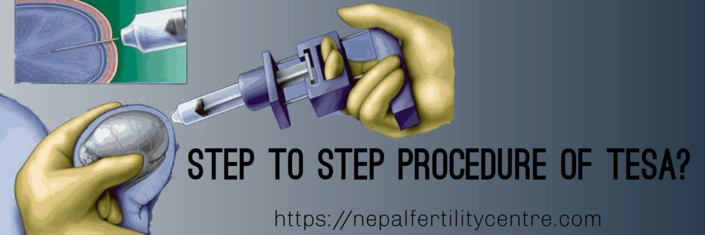 TESA treatment cost in Nepal`